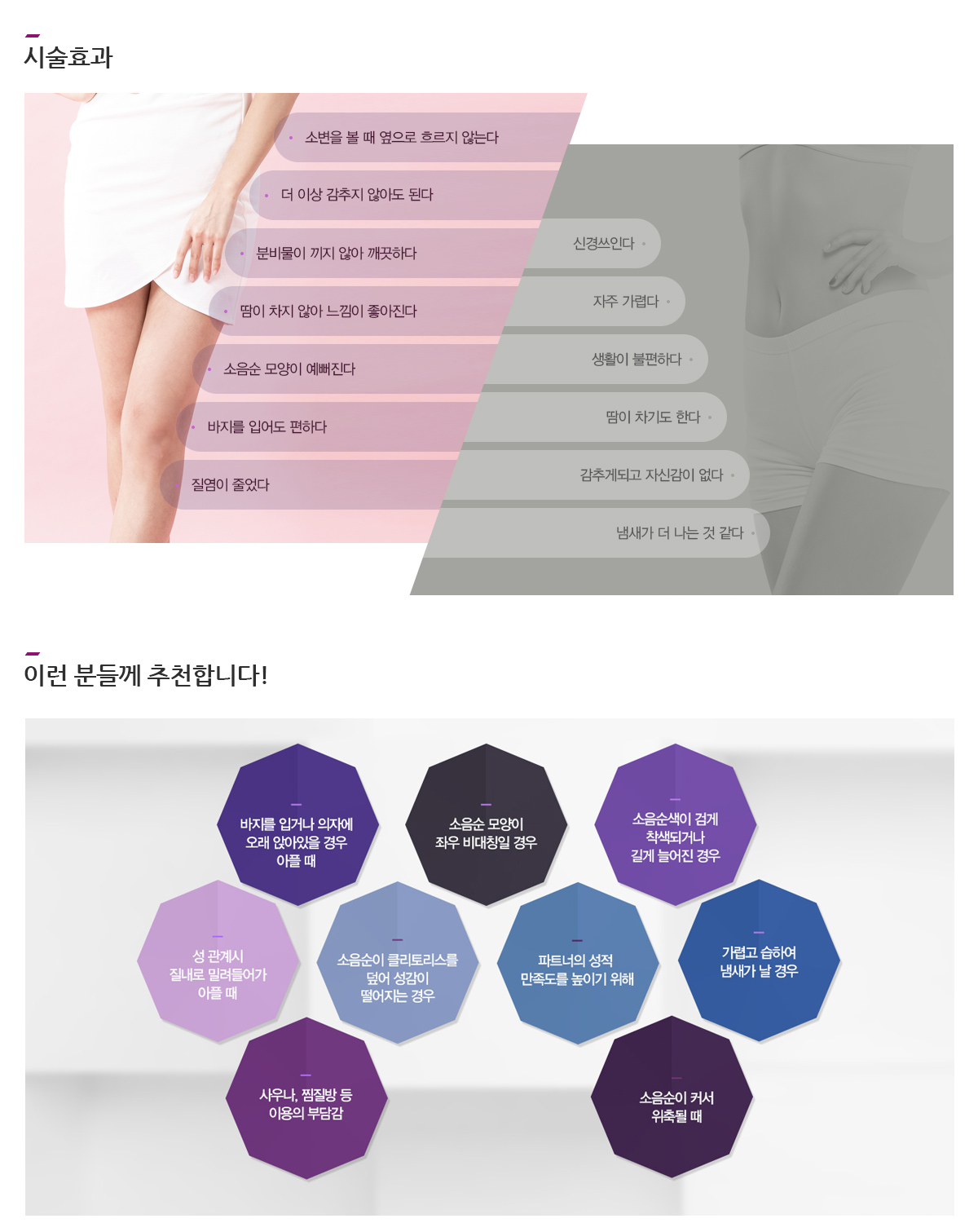시술효과 시술 전(신경쓰인다, 자주 가렵다, 생활이 불편하다, 땀이 차기도 한다, 감추게되고 자신감이 없다, 냄새가 더 나는 것 같다) 시술 후(소변을 볼 때 옆으로 흐르지 않는다, 더 이상 감추지 않아도 된다, 분비물이 끼지 않아 깨끗하다, 땀이 차지 않아 느낌이 좋아진다, 소음순 모양이 예뻐진다, 바지를 입어도 편하다, 질염이 줄었다) 이런 분들께 추천합니다! 바지를 입거나 의자에 오래 앉아있을 경우 아플 때, 소음순 모양이 좌우 비대칭일 경우, 소음순색이 검게 착색되거나 길게 늘어진 경우, 소음순이 클리토리스를 덮어 성감이 떨어지는 경우, 가렵고 습하여 냄새가 날 경우, 사우나, 찜질방 등 이용의 부담감, 소음순이 커서 위축될 때, 성 관계시 질내로 밀려들어가 아플 때
