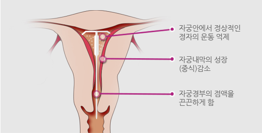 미레나